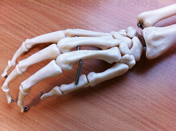 Artificial Hand