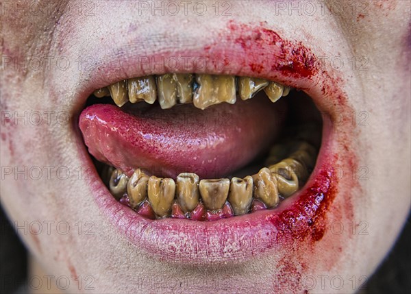 Rotten zombie teeth