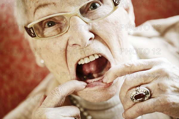 Senior suffering from dementia showing her mouth with missing teeth