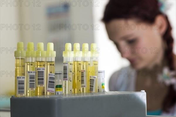 Capillary tubes filled with yellow urine