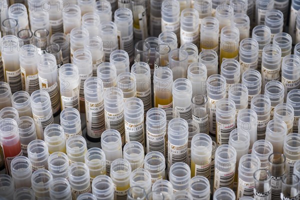 Examined samples in transparent capillary tubes are sorted in grey racks