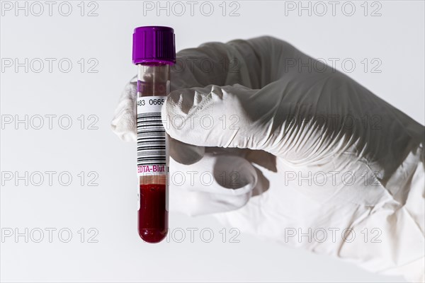 Laboratory assistant's hand holding a monovette containing EDTA