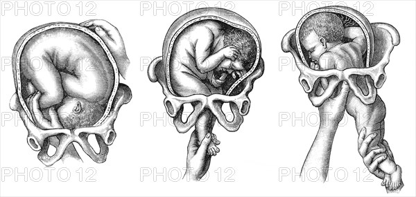 Parturition