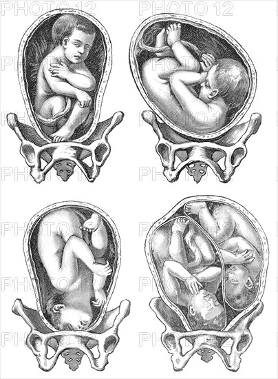 Parturition