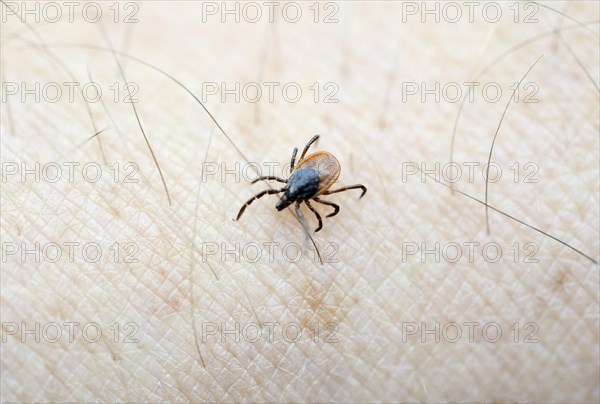 Castor Bean Tick (Ixodes ricinus) crawling on human skin