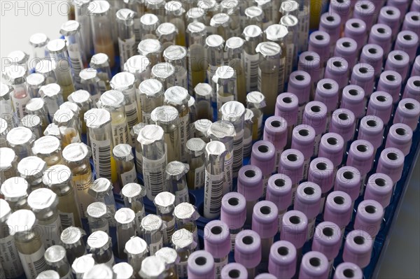 Test tubes with samples in a medical laboratory