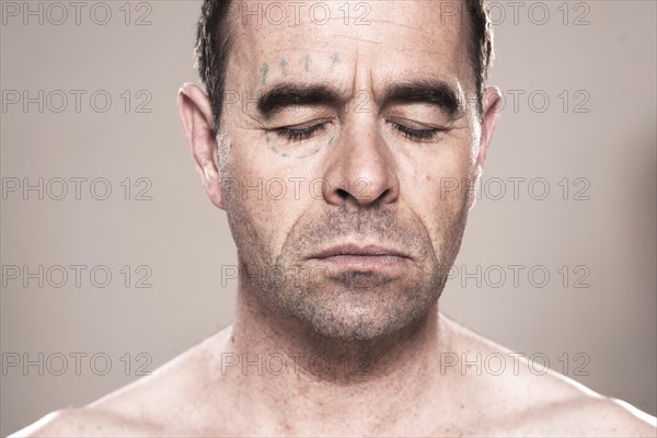 Man with markings for plastic surgery on his face