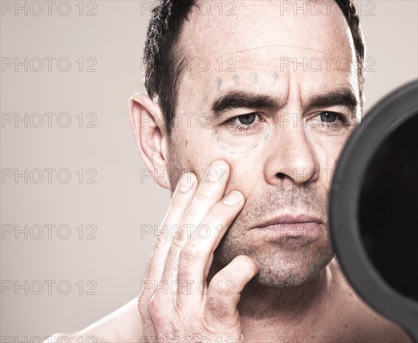 Man with markings for plastic surgery on his face