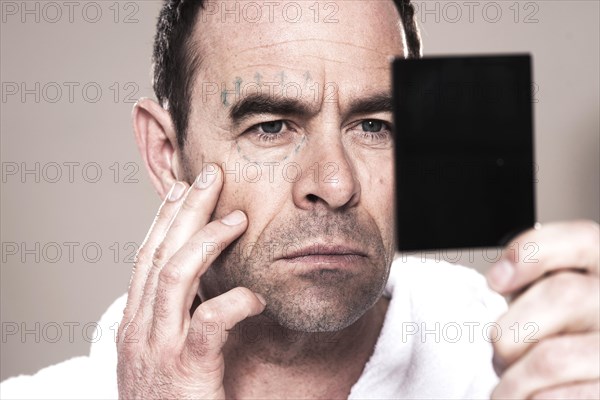 Man with markings for plastic surgery on his face