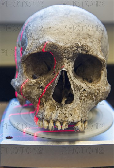 A scanner making a 3D photograph of the skull of an unidentified migrant