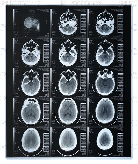 Scan of a human brain