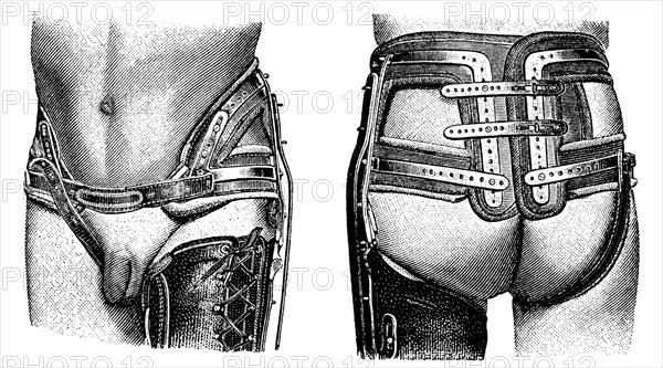 Pelvic girdle