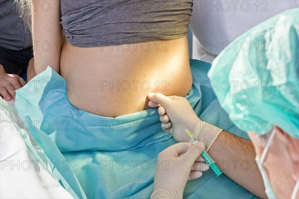 Pregnant women during delivery in the delivery room with an anesthesiologist applying a PDA or epidural