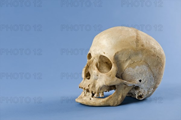 Human skull