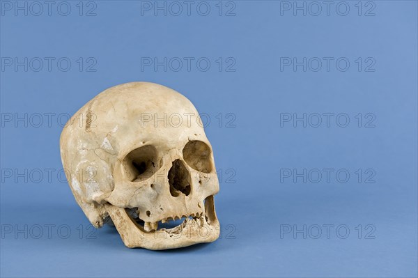 Human skull