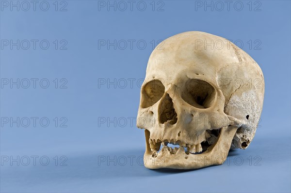 Human skull