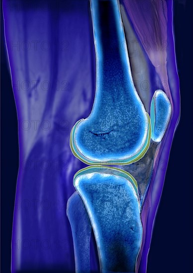 Knee joint