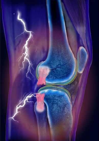 Knee joint