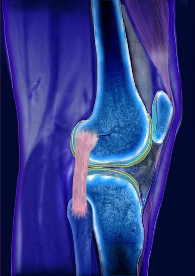 Knee joint