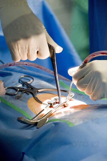 Hands of a neurosurgeon during spinal surgery in an operating room