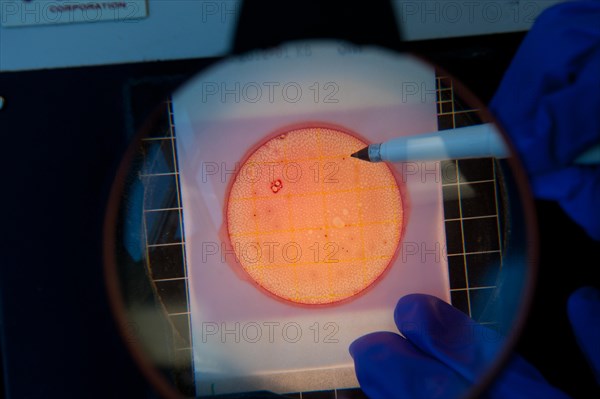 Scientist counting cultures on a petri dish