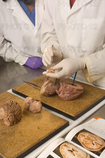 Dissection of a brain in science lab