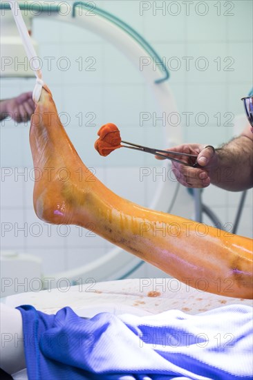Rubbing one leg with iodine in front of an operation
