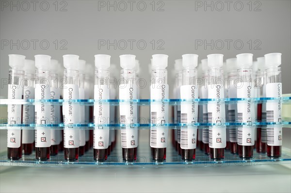 Positive results of corona virus tests