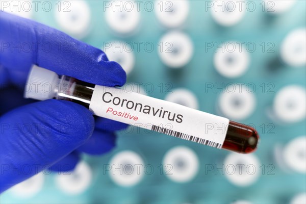 Laboratory physician holding a test tube with positive results of the coronavirus test