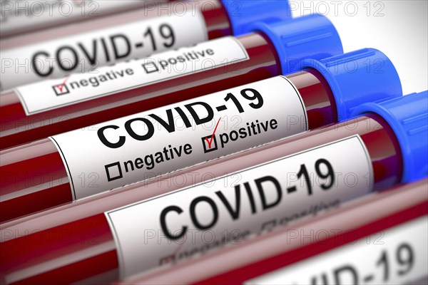 3D illustration of blood test tubes with positive COVID-19 test in the center. Concept for laboratory sample of blood testing for diagnosis of the new Corona virus infection with selective focus