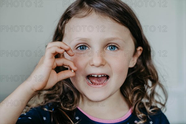 Girl with gap and fallen tooth in her hand