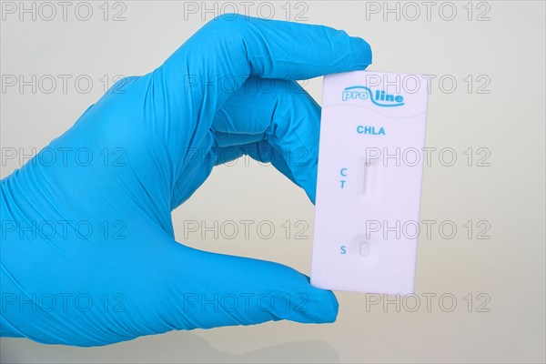 Quick test chlamydia of the company ProLine