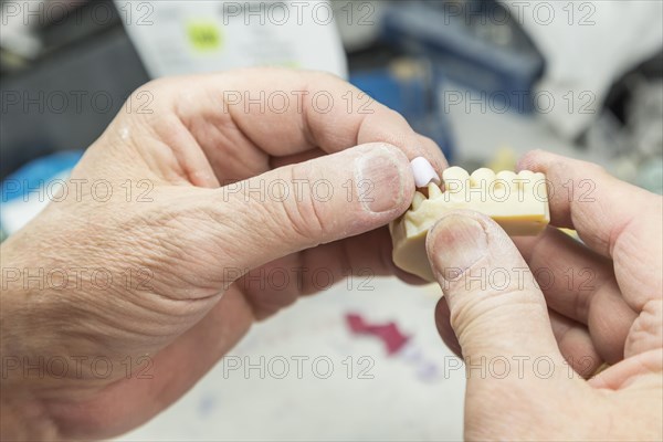 Male dental technician working on A 3D printed mold for tooth implants in the lab