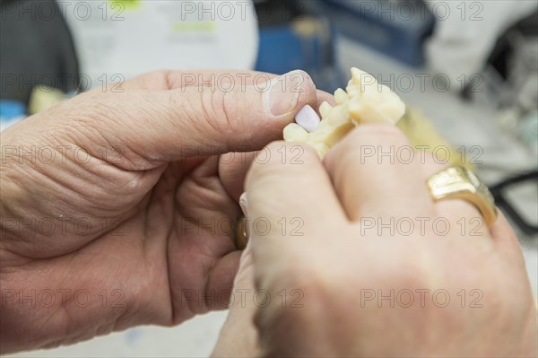 Male dental technician working on A 3D printed mold for tooth implants in the lab