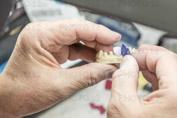 Male dental technician working on A 3D printed mold for tooth implants in the lab