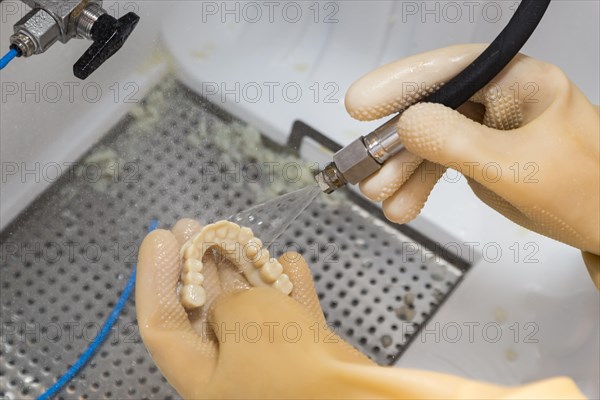 Dental technician cleans 3D printed dental implant bridge in lab with water