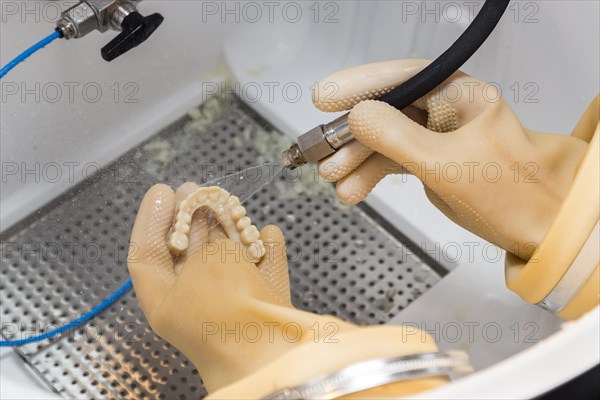 Dental technician cleans 3D printed dental implant bridge in lab with water