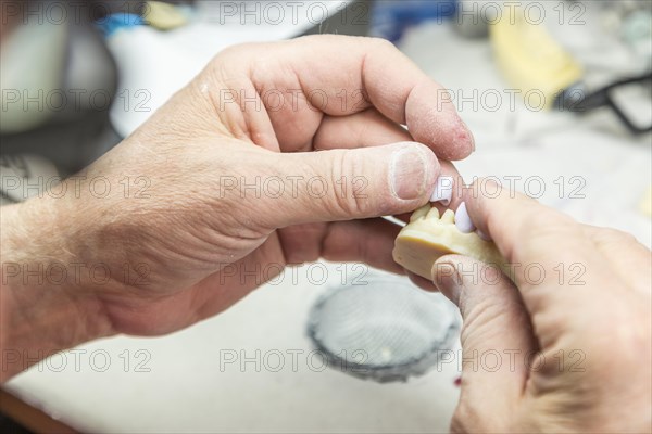 Male dental technician working on A 3D printed mold for tooth implants in the lab