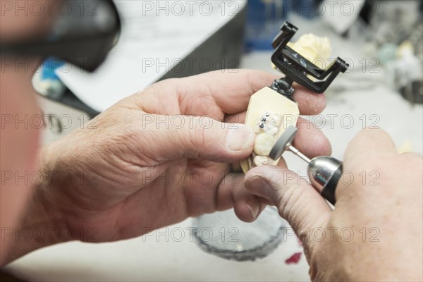 Male dental technician working on A 3D printed mold for tooth implants in the lab