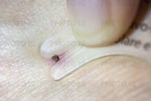 Castor Bean Tick (Ixodes ricinus)