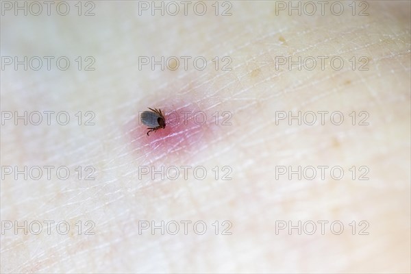 Castor Bean Tick (Ixodes ricinus)