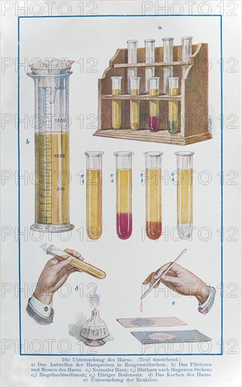 Urine examination