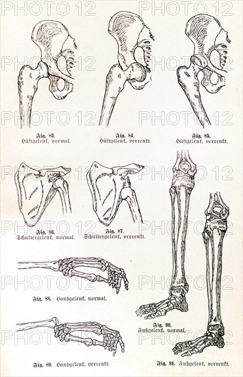 Dislocations (Lurations)