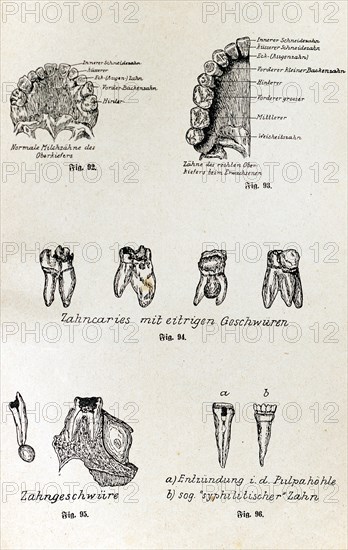 The teeth and their diseases