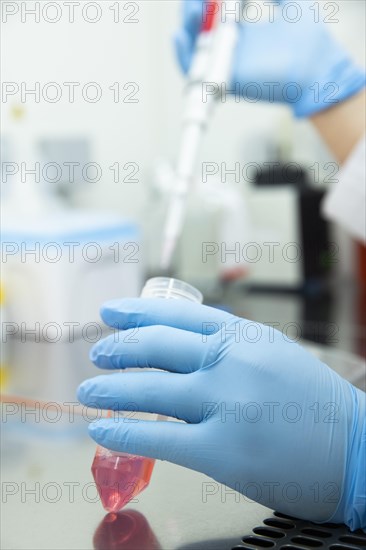 Medical laboratory assistant fills a blood sample into a centrifuge tube with a pipette