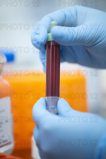 Medical laboratory assistant holding a tube with blood