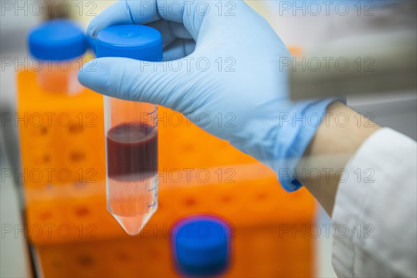 Medical laboratory assistant holding a centrifuge tube with blood