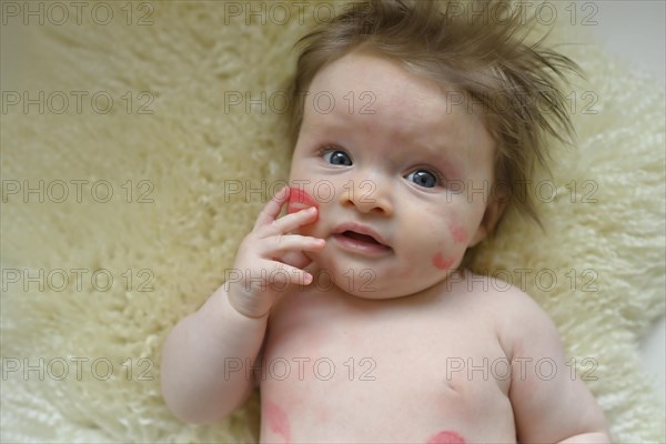 Infant