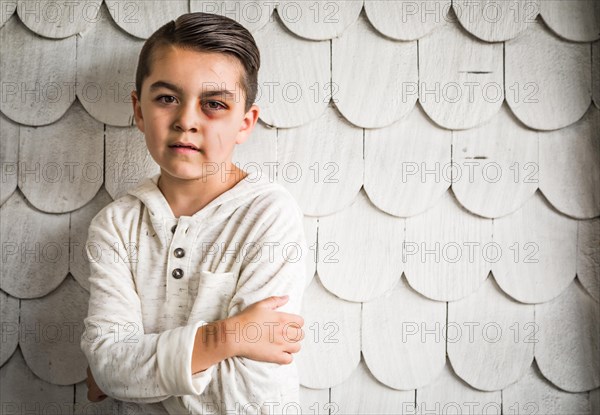 Sad and afraid mixed-race boy with bruises and black eye