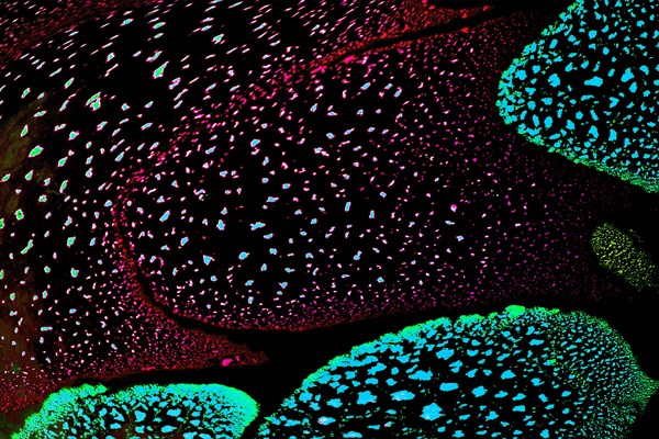 Oil bubbles inside water base form patterns